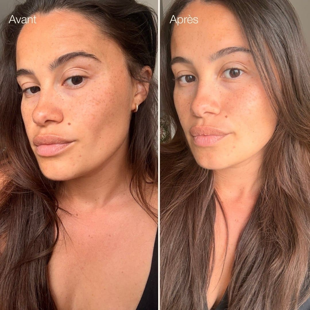 Avant-après ice globes visage Method Skin, visage décongestionné et poches sous les yeux diminuées Image