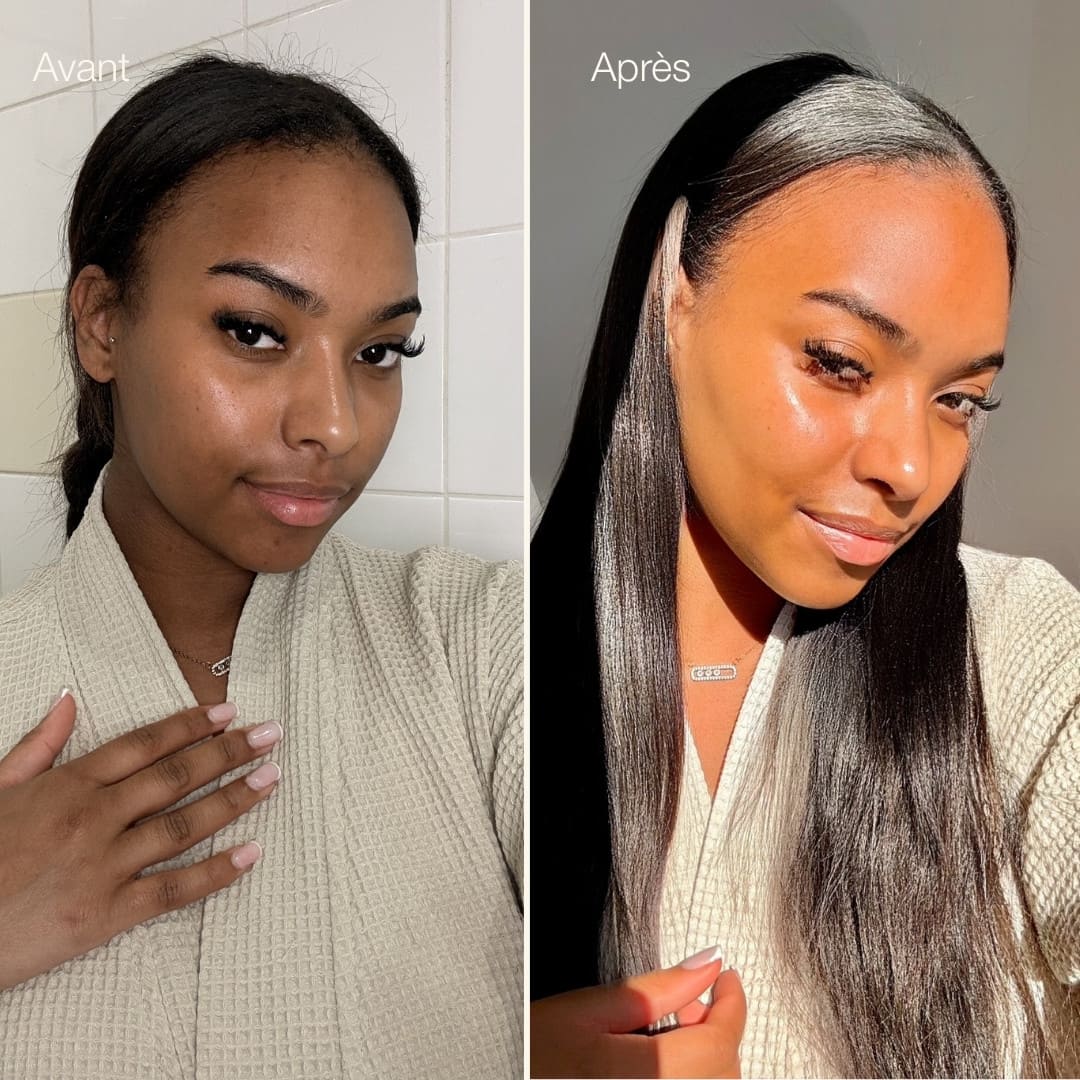 Avant-après ice globes visage Method Skin, peau plus lumineuse et cernes réduites Image