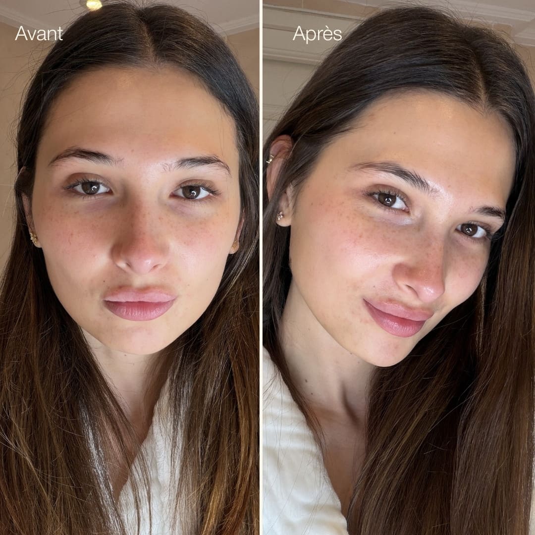 Avant-après ice globes visage Method Skin, peau plus lumineuse et décongestionnée Image