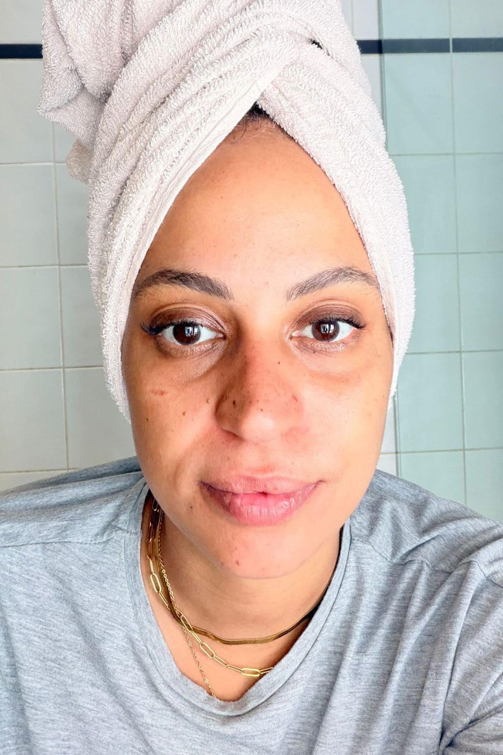 Photo après utilisation des Ice Globes Method Skin montrant le visage reposé et les cernes atténués de Marie après la routine visage