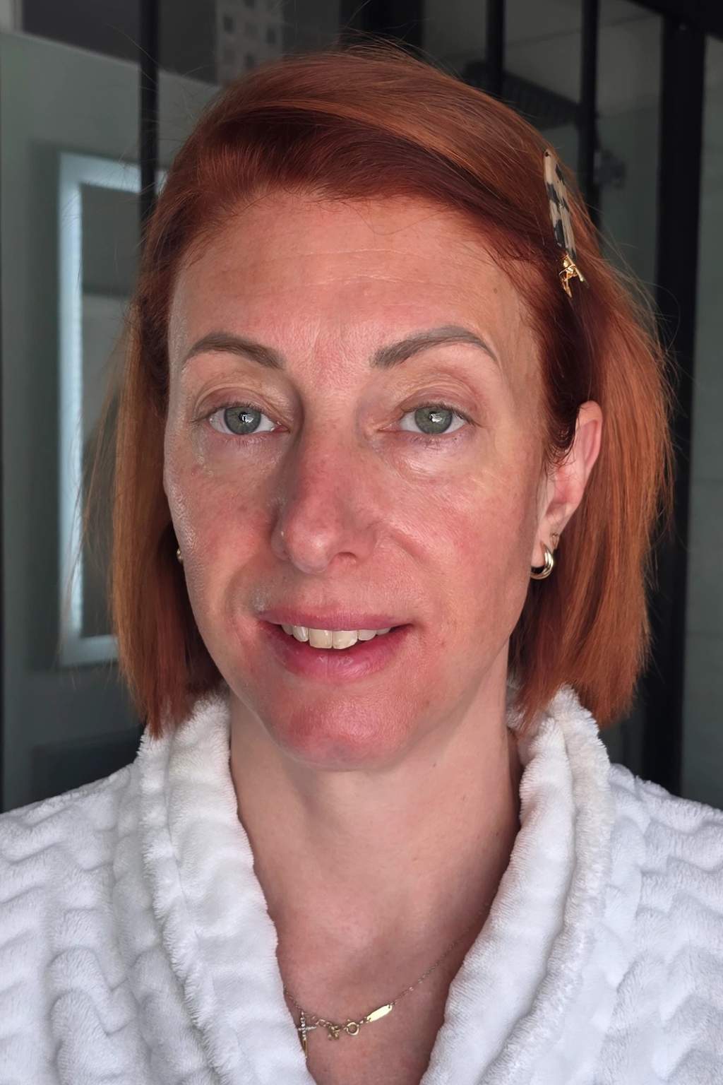 Photo après utilisation des Ice Globes Method Skin montrant le visage reposé de Vanessa après la routine visage