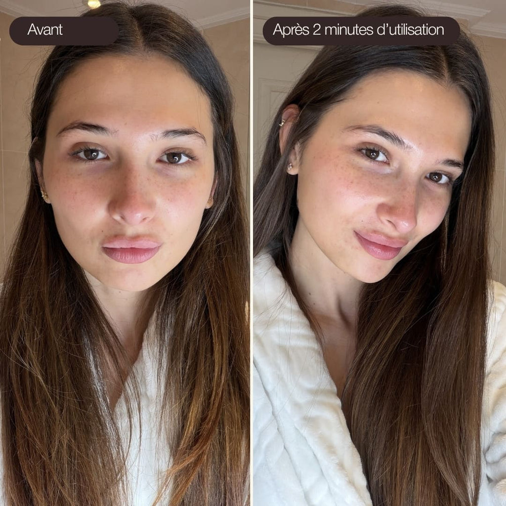 Photo avant-après utilisation des Ice Globes Method Skin montrant le visage de Laetitia plus apaisé et lumineux après 2 minutes de routine visage