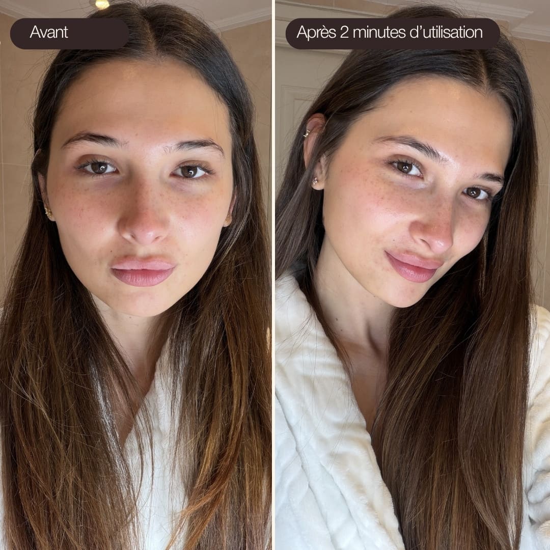 Photo avant-après utilisation des Ice Globes Method Skin montrant le visage de Laetitia plus apaisé et lumineux après 2 minutes de routine visage
