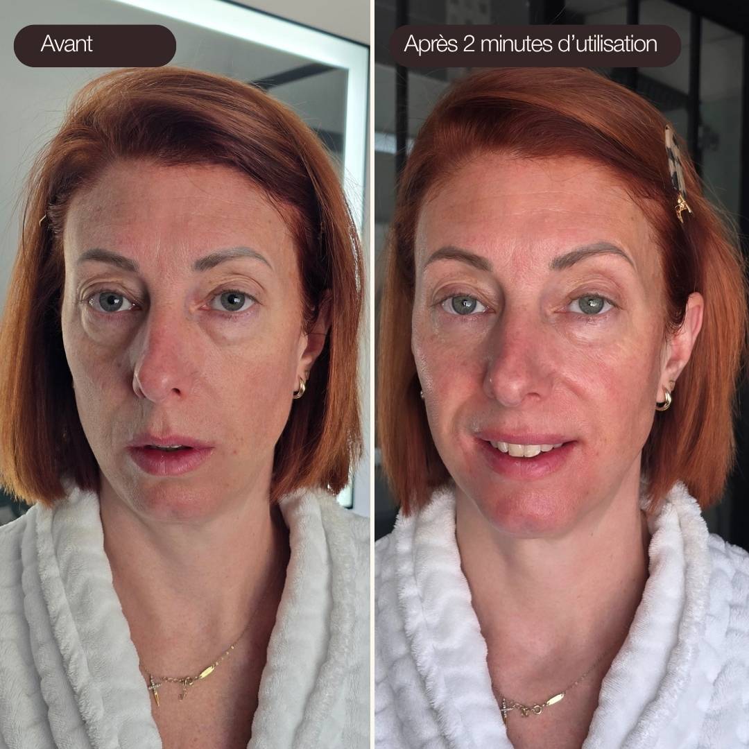 Photo avant/après d’une femme utilisant les Ice Globes Method Skin pendant 2 minutes pour décongestionner le visage, réduire les poches sous les yeux.