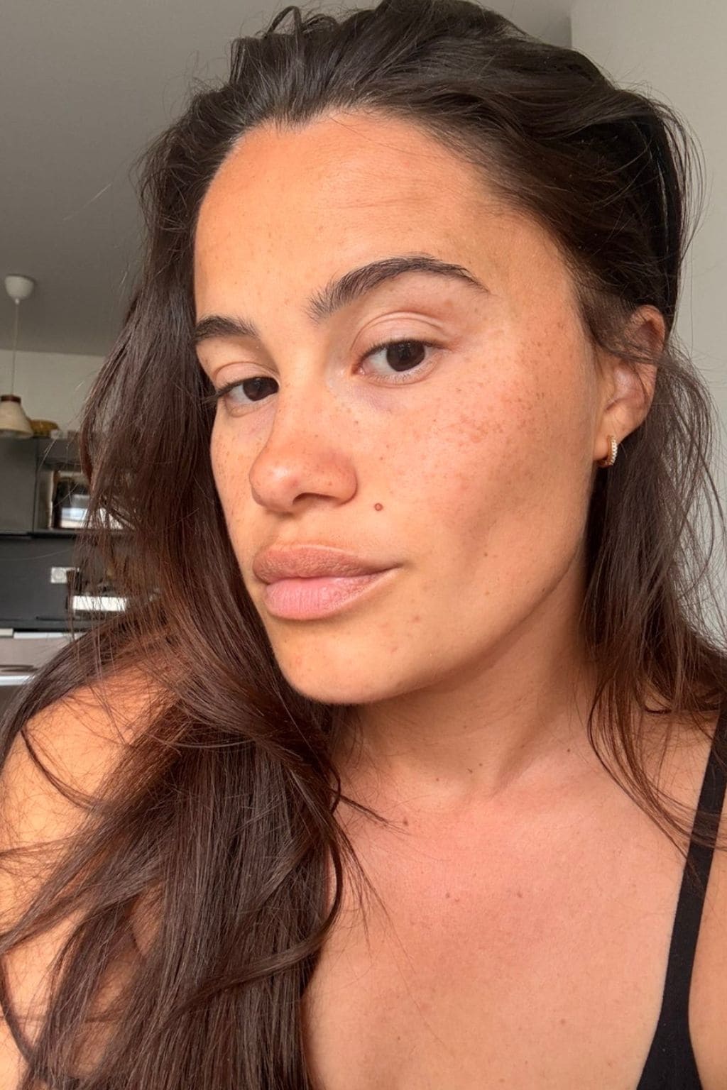 Photo avant utilisation des Ice Globes Method Skin montrant les poches et le visage gonflé d'Elisa avant la routine visage