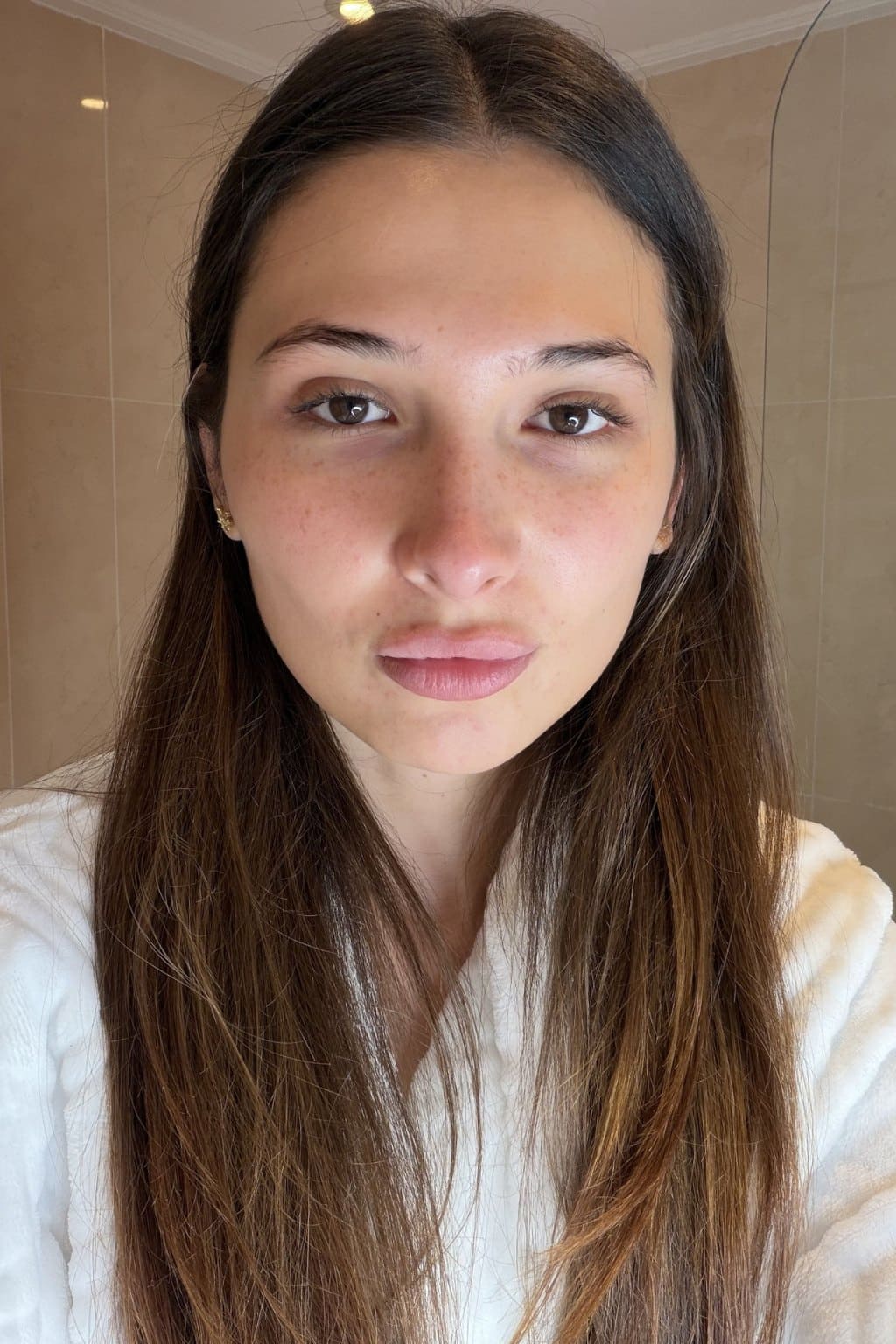 Photo avant utilisation des Ice Globes Method Skin montrant le visage congestionné de Laetitia avant la routine visage