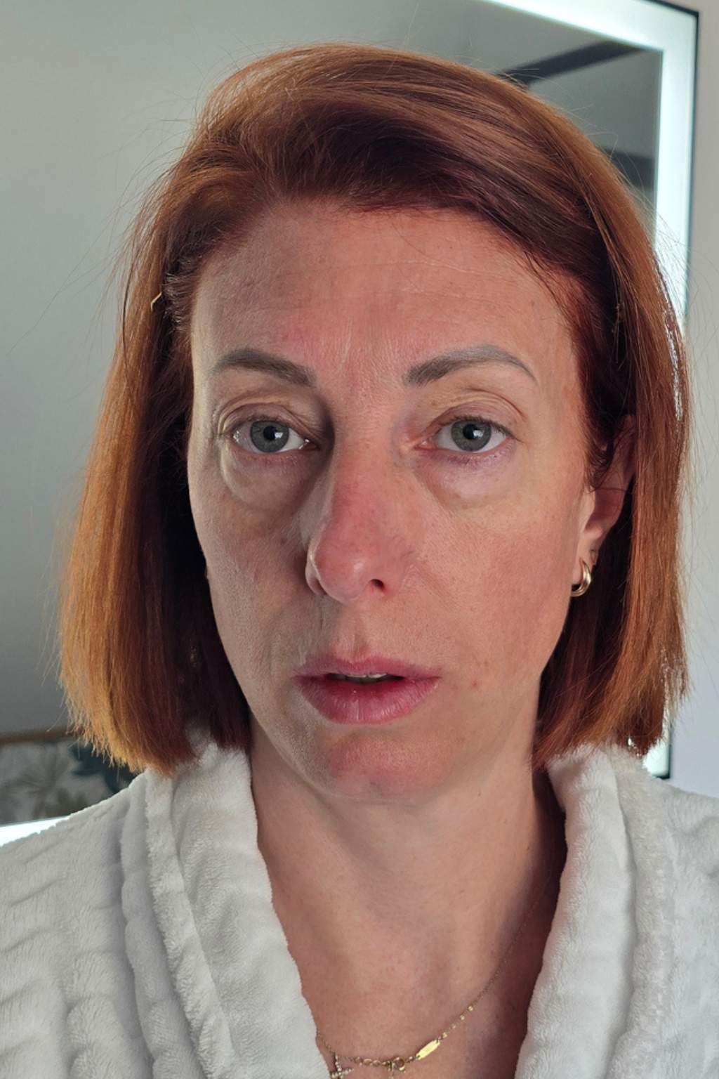 Photo avant utilisation des Ice Globes Method Skin montrant le visage fatigué e Vanessa avant la routine visage